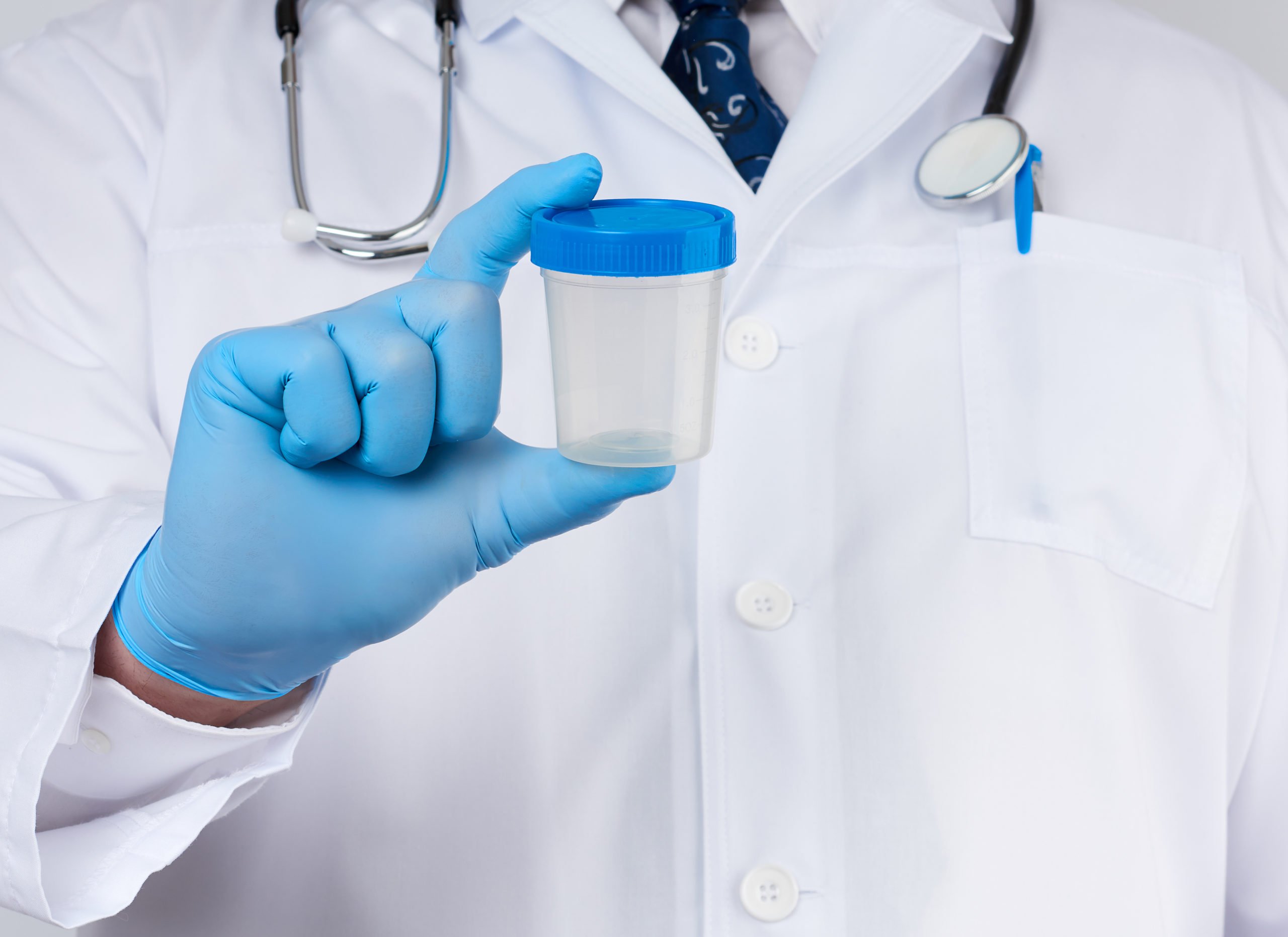 doctor in a white coat and tie stands and holds a plastic container for urine specimen